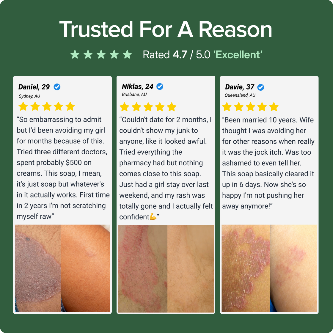 Veloma Antifungal Soap®