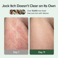 Veloma Antifungal Soap®
