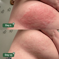 Veloma™ Antifungal Soap