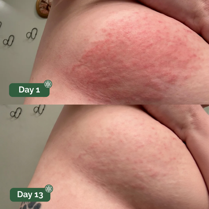 Veloma® Antifungal Soap