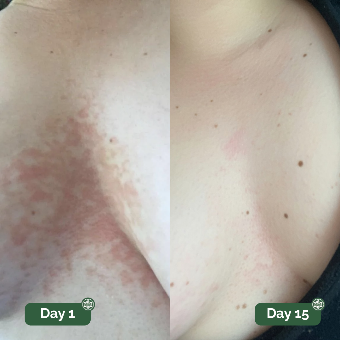 Veloma™ Antifungal Soap