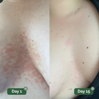 Veloma™ Antifungal Soap