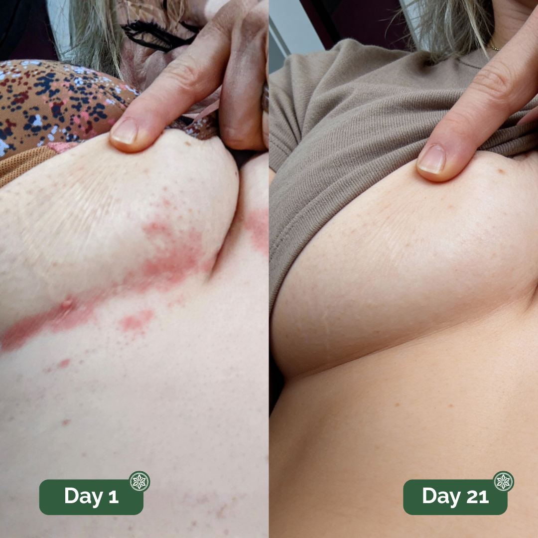 Veloma™ Antifungal Soap