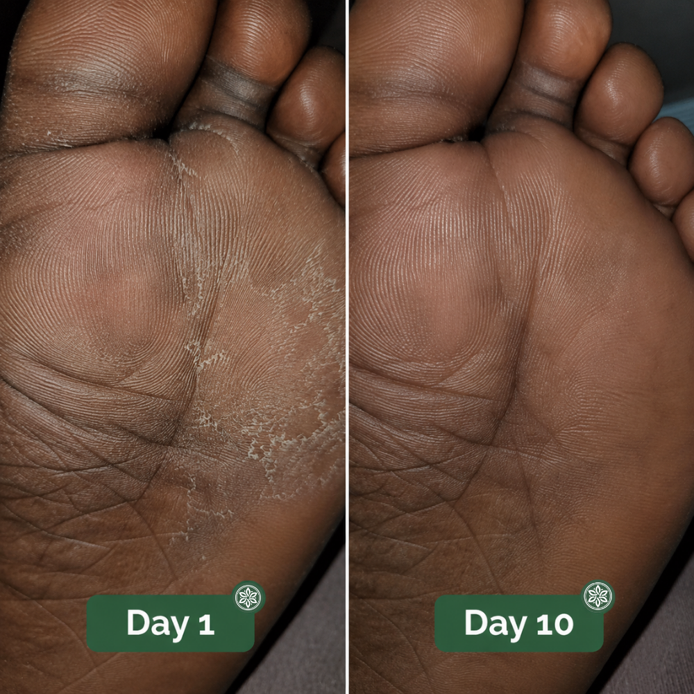 Veloma Antifungal Soap®
