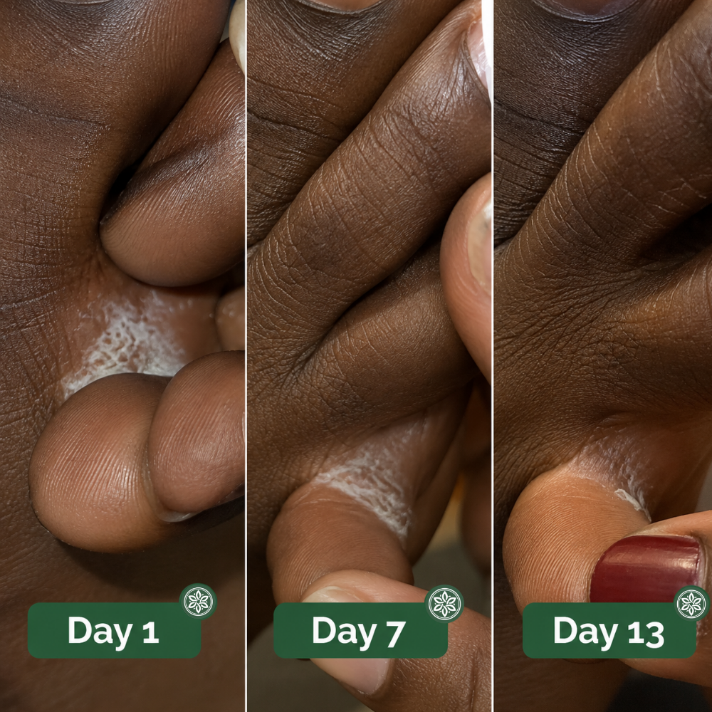 Veloma Antifungal Soap®