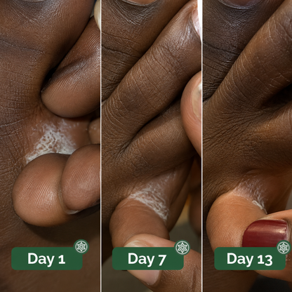 Veloma Antifungal Soap®