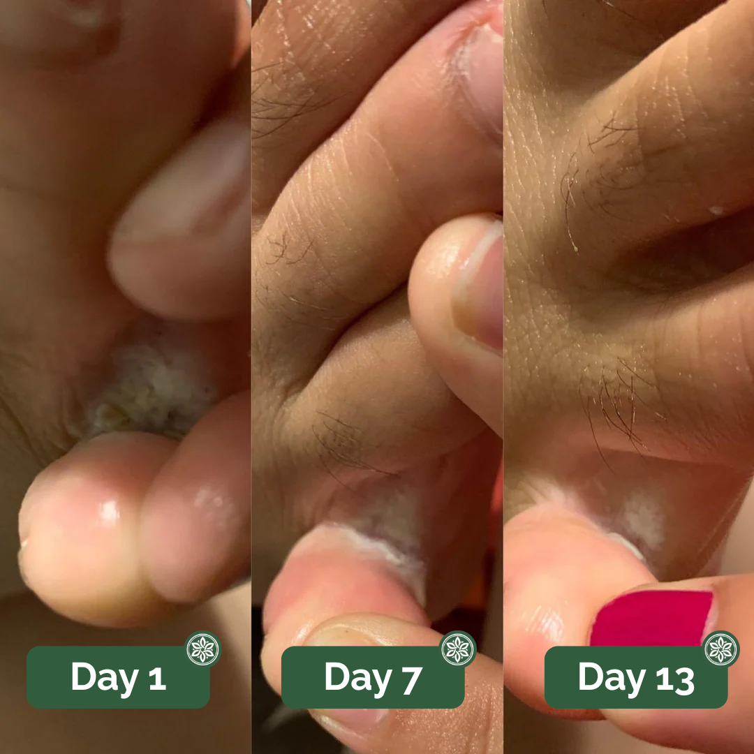 Veloma Antifungal Soap®