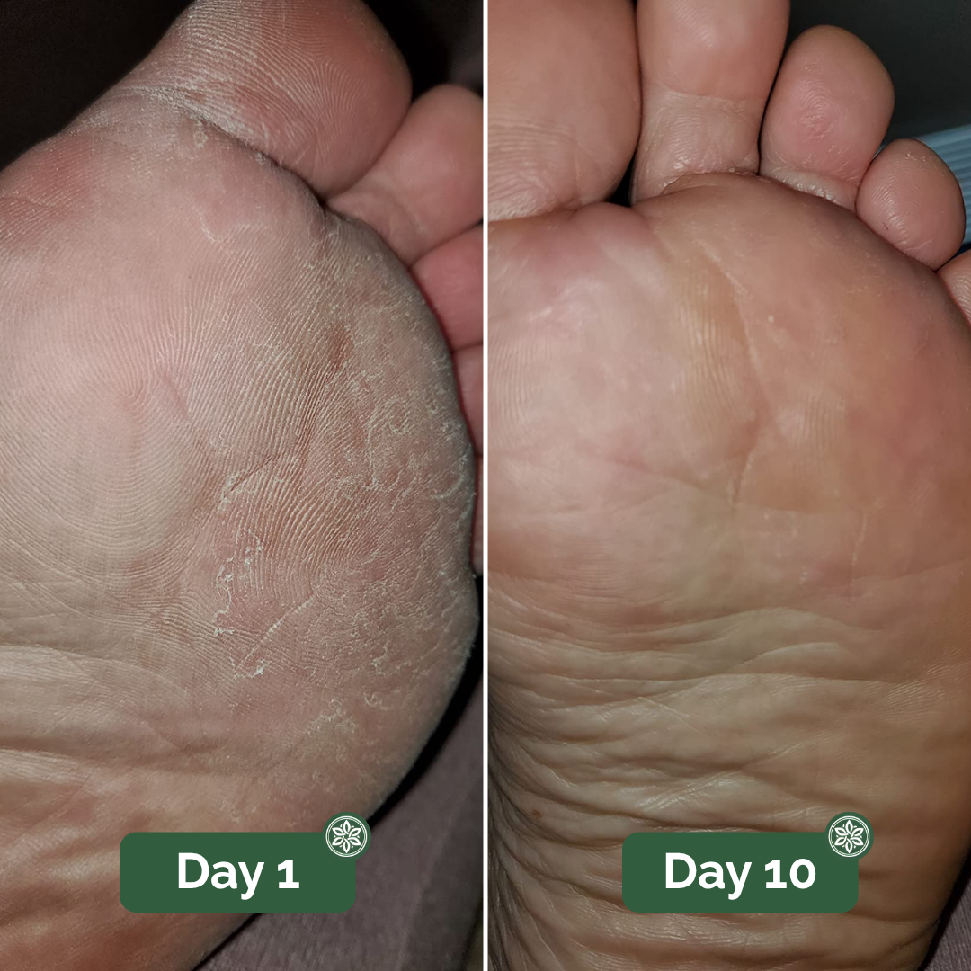 Customer progress image