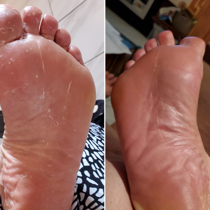 Veloma Antifungal Soap®