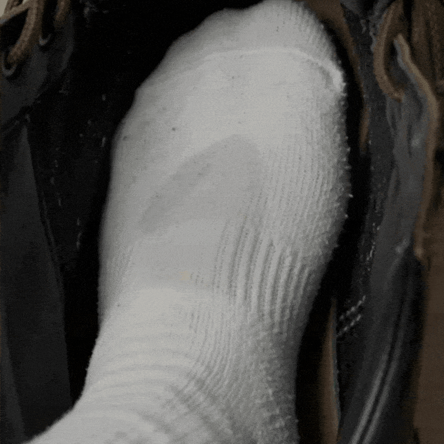Treating Athlete's Foot Is Only Half The Battle