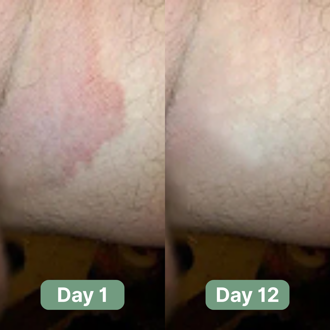 Andrew's Antifungal Soap®