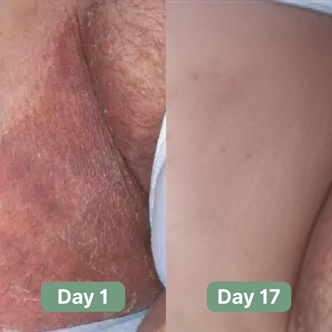 Andrew's Antifungal Soap®
