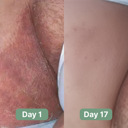 Andrew's Antifungal Soap®
