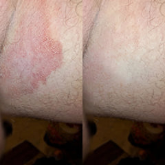 Veloma Antifungal Soap®