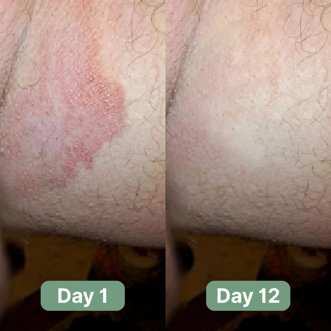 Veloma Antifungal Soap®