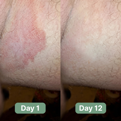 Veloma Antifungal Soap®